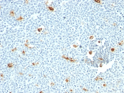 Formalin-fixed, paraffin embedded human tonsil sections stained with 100 ul anti-Macrophage (clone LN-5) at 1:400. HIER epitope retrieval prior to staining was performed in 10mM Citrate, pH 6.0.